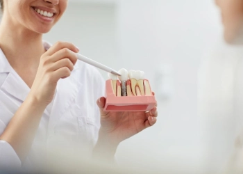 How Long Do Dental Implants Last?