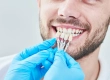 How Many Teeth Do You Need For Veneers?