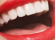 How Much Does Hollywood Smile Treatment Cost?
