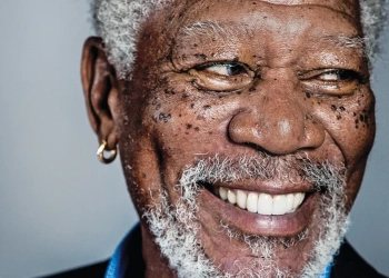 Morgan Freeman Teeth: Smile Restoration & Veneers