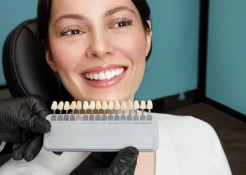 What Is The 4 8 10 Rule For Veneers?
