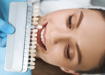 Why Are Veneers So Cheap In Turkey?